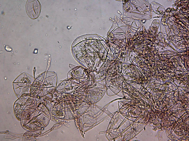 Amanita pantherina 14 - Hifas velo x 400